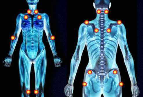 La fibromyalgie se caractérise par l'apparition de douleurs musculaires diffuses, chroniques et multiples ainsi que par une fatigue, accompagnée de troubles du sommeil. la fibromyalgie maladie du siècle