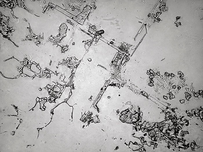 Topographie des larmes : parfaitement stupéfiant